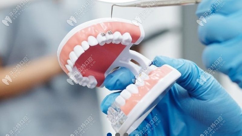 长期抽烟者洗牙喷砂效果如何？揭秘洗牙喷砂的真相