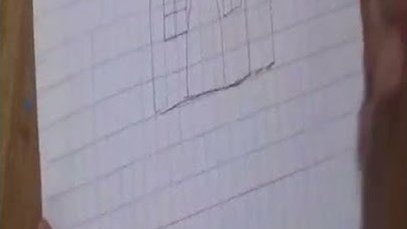 根管治疗填充材料：操作流程揭秘